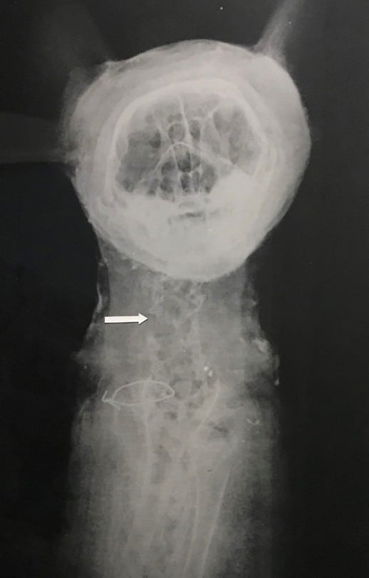 x-ray of cat mummy