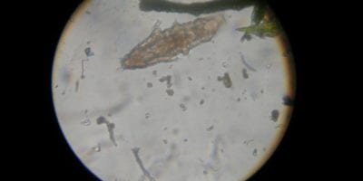 image of a water bear