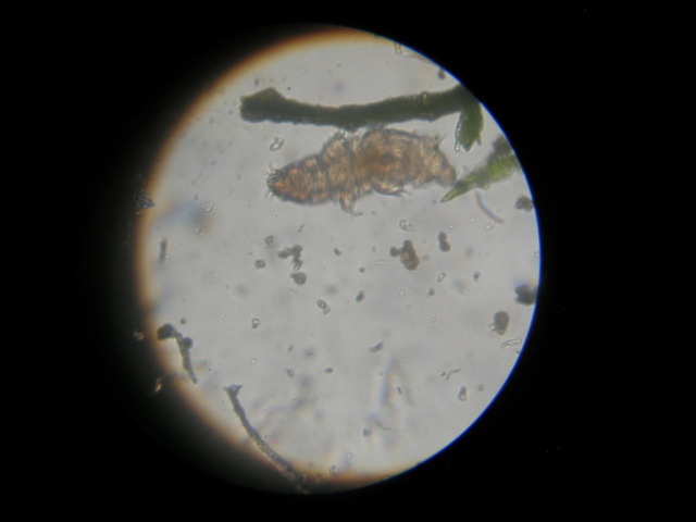 image of a tardigrade